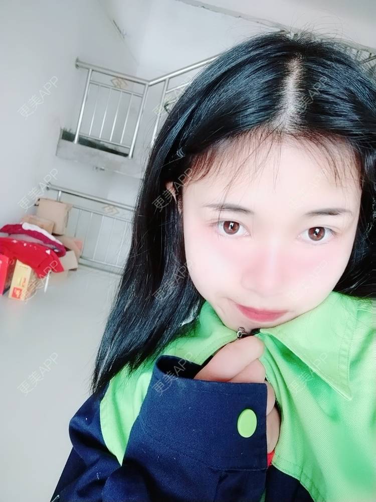 更美 - 更美用户lM8eMwz0OI的热玛吉经验 | 福州 | 热玛吉