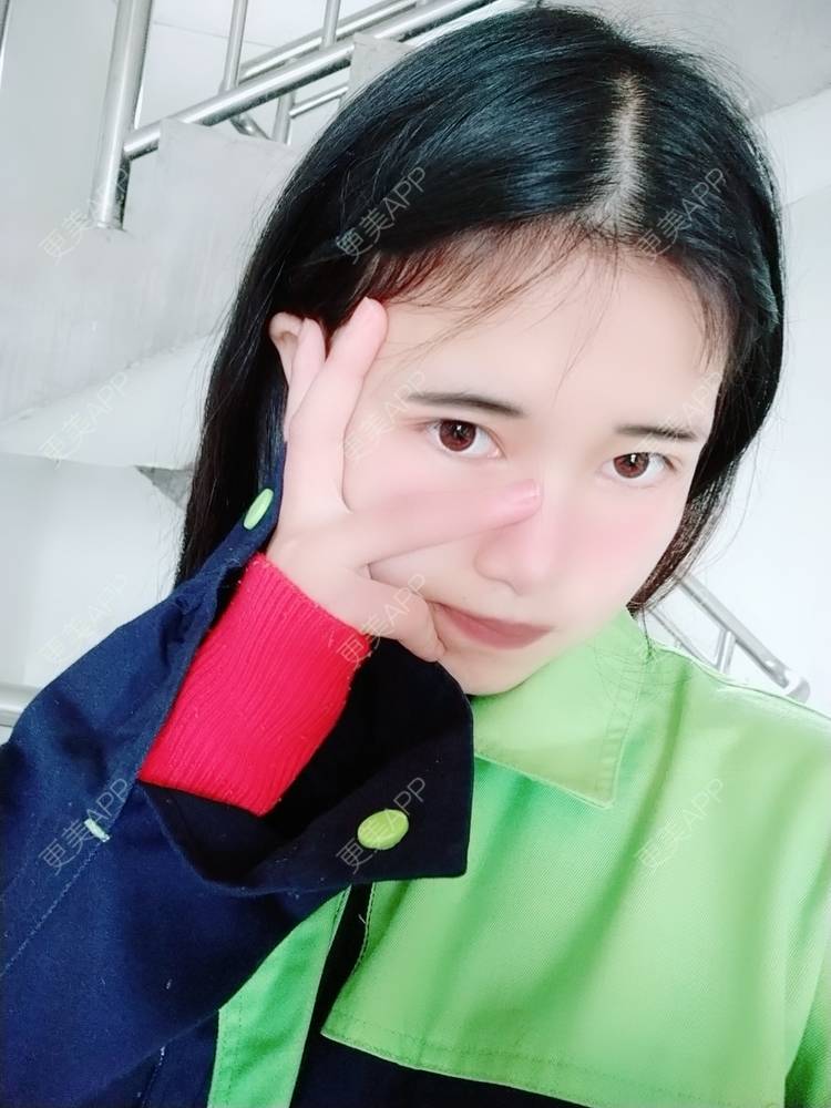 更美 - 更美用户lM8eMwz0OI的热玛吉经验 | 福州 | 热玛吉