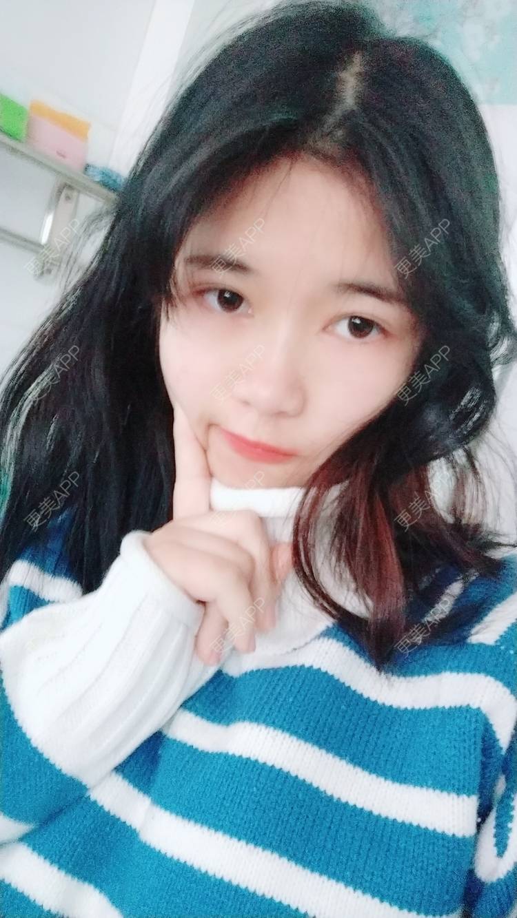 更美 - 更美用户lM8eMwz0OI的热玛吉经验 | 福州 | 热玛吉