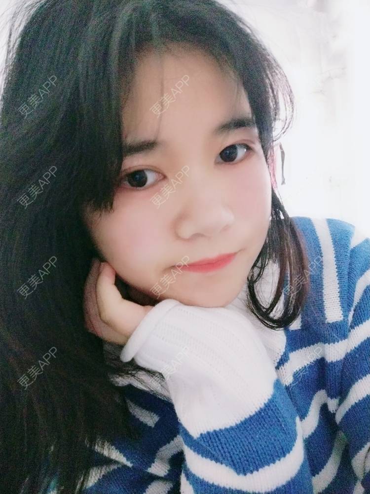 更美 - 更美用户lM8eMwz0OI的热玛吉经验 | 福州 | 热玛吉