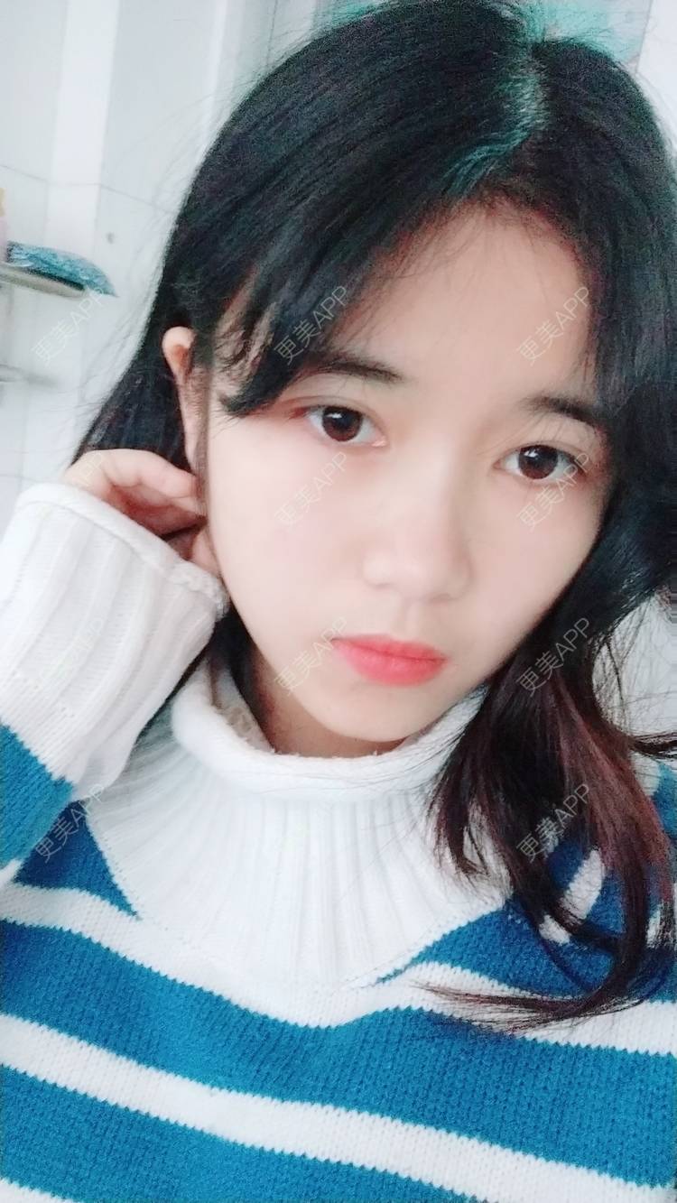 更美 - 更美用户lM8eMwz0OI的热玛吉经验 | 福州 | 热玛吉