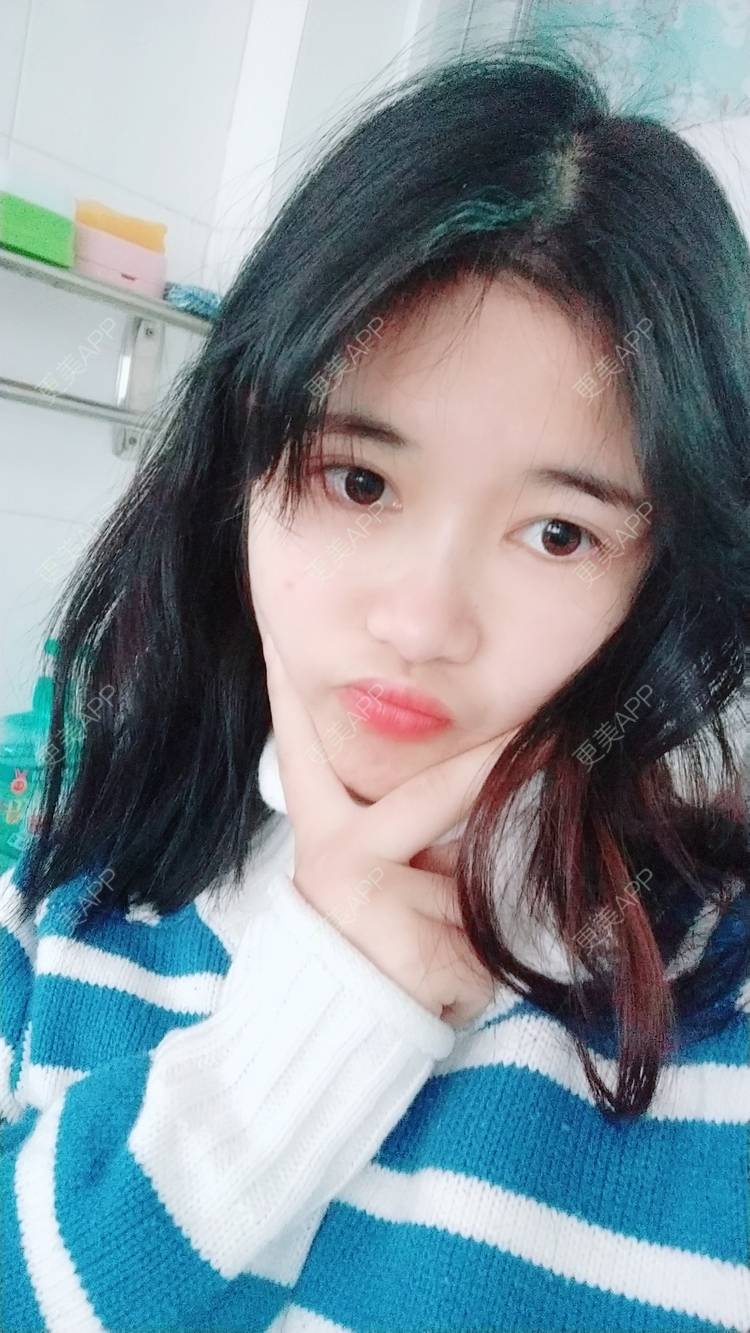 更美 - 更美用户lM8eMwz0OI的热玛吉经验 | 福州 | 热玛吉