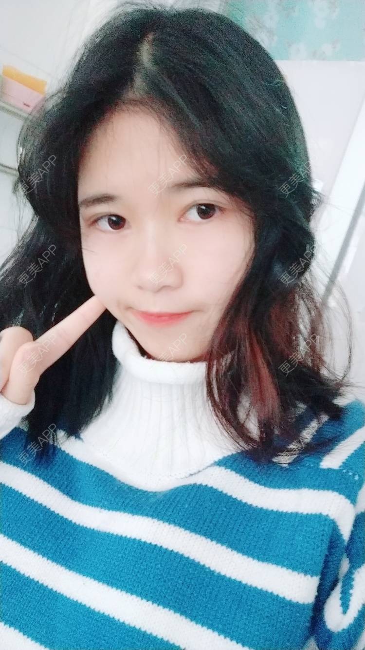 更美 - 更美用户lM8eMwz0OI的热玛吉经验 | 福州 | 热玛吉