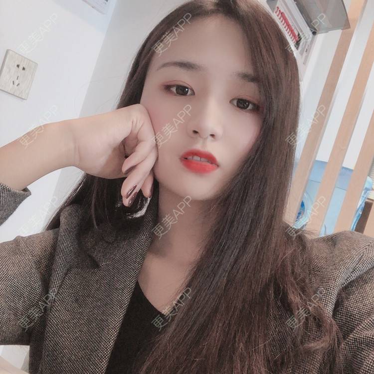 更美 - 更美用户KNVQlJmCkG的下颌角切除经验 | 广州 | 下颌角切除