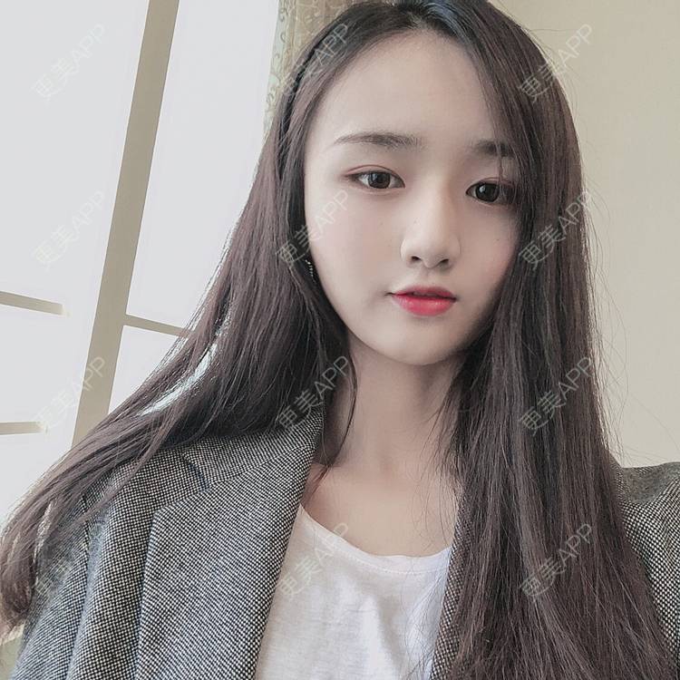 更美 - 更美用户KNVQlJmCkG的下颌角切除经验 | 广州 | 下颌角切除