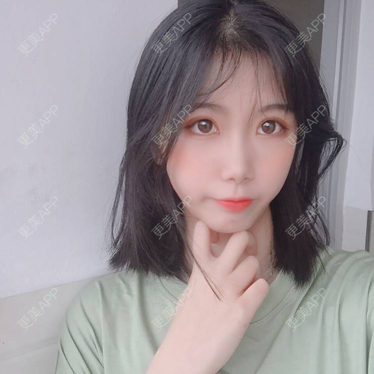 更美 - 更美用户5BT75lvkBb的热玛吉经验 | 广州 | 热玛吉