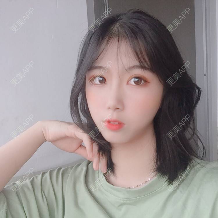 更美 - 更美用户5BT75lvkBb的热玛吉经验 | 广州 | 热玛吉