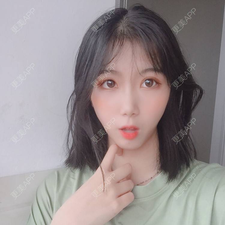 更美 - 更美用户5BT75lvkBb的热玛吉经验 | 广州 | 热玛吉