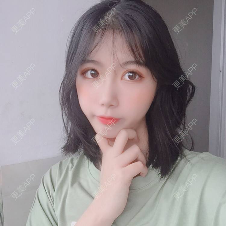 更美 - 更美用户5BT75lvkBb的热玛吉经验 | 广州 | 热玛吉