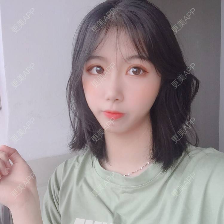 更美 - 更美用户5BT75lvkBb的热玛吉经验 | 广州 | 热玛吉