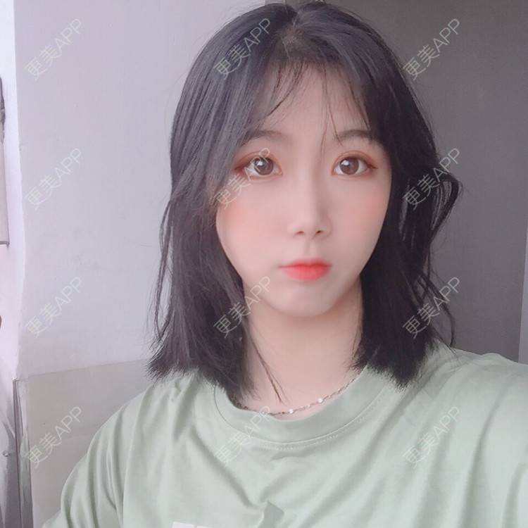 更美 - 更美用户5BT75lvkBb的热玛吉经验 | 广州 | 热玛吉