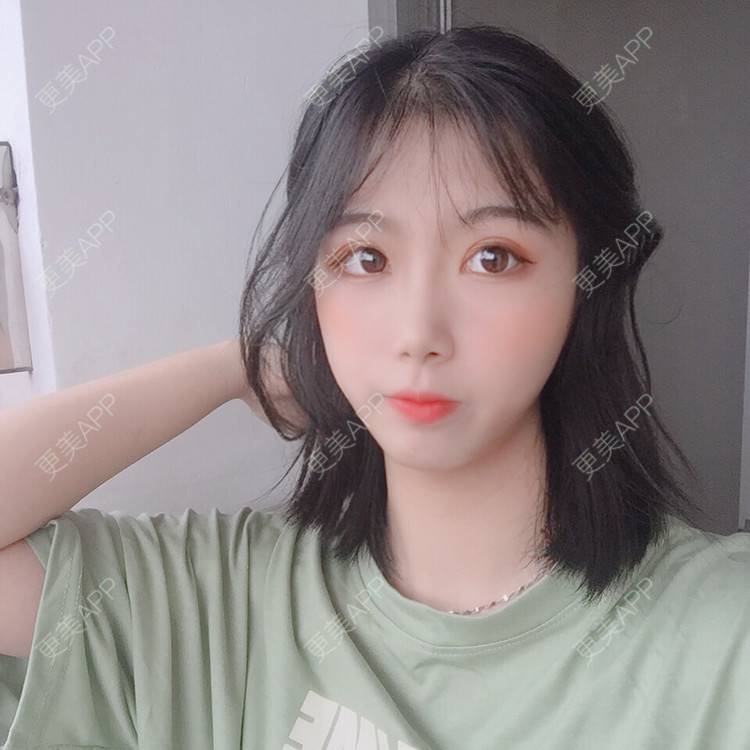 更美 - 更美用户5BT75lvkBb的热玛吉经验 | 广州 | 热玛吉