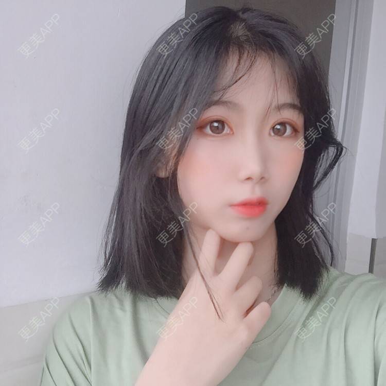 更美 - 更美用户5BT75lvkBb的热玛吉经验 | 广州 | 热玛吉