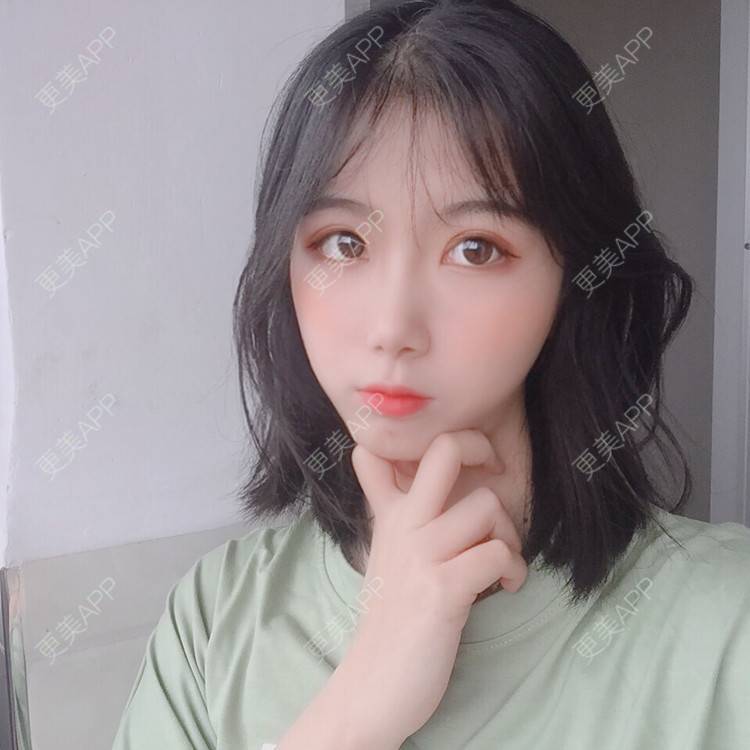 更美 - 更美用户5BT75lvkBb的热玛吉经验 | 广州 | 热玛吉