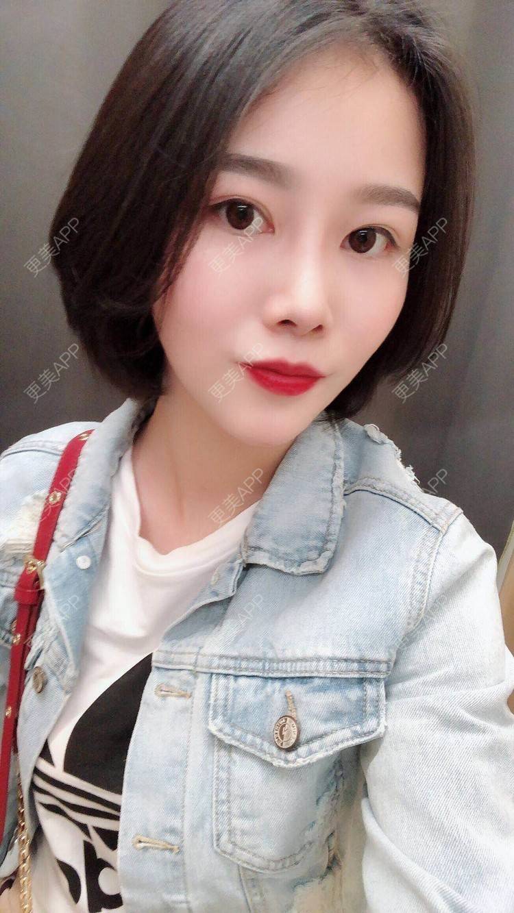 更美 - 鲁噜噜的经验 | 视频日记 | 隆鼻 | 重庆