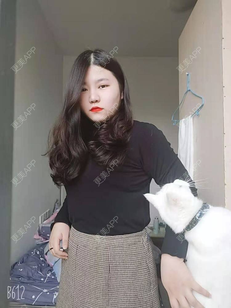 更美 - 你啊🎈的鼻部多项经验 | 鼻中隔软骨隆鼻 | 肋软骨隆鼻 | 鼻翼缩小 | 鼻小柱延长 | 鼻部多项 | 手术缩鼻头 | 自体软骨垫鼻尖 | 埋线隆鼻 | 鼻中隔软骨垫鼻头 | 注射缩鼻头 | 耳软骨隆鼻 | 鼻小柱缩短