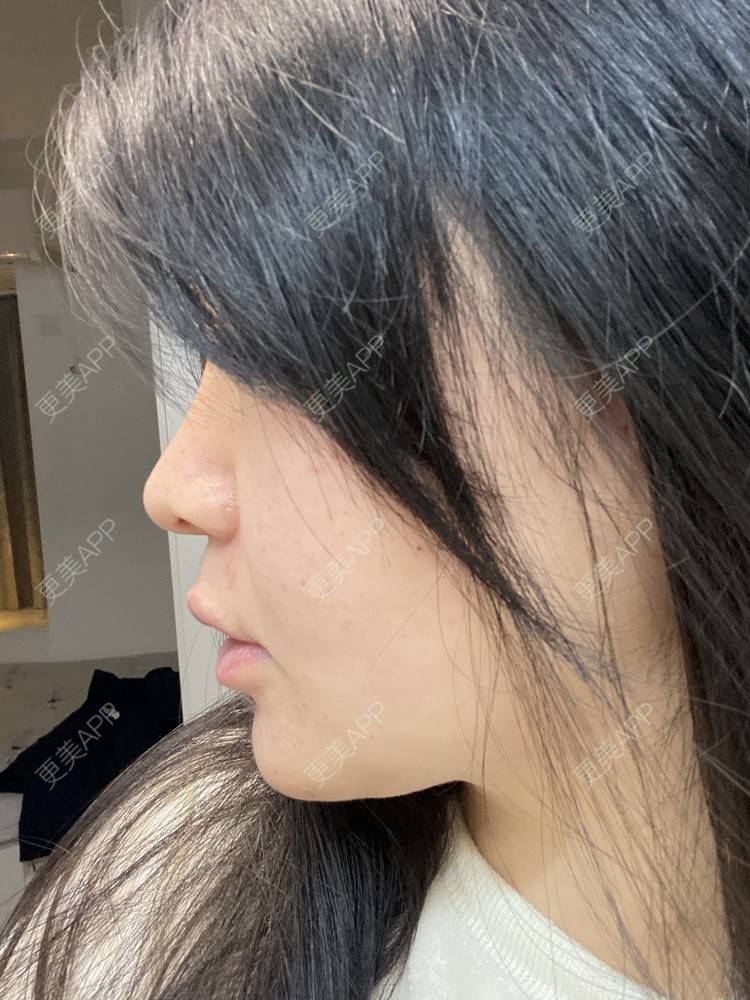 更美 - 张全蛋🐾的水光项目经验 | 水光项目 | 菲欧曼 | 武汉
