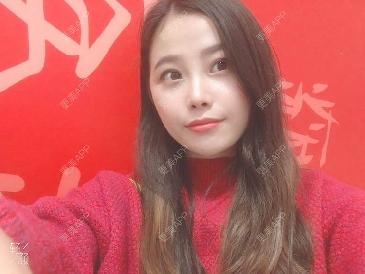 更美 - 今夜沉眠如凉的双眼皮经验 | 广州 | 双眼皮