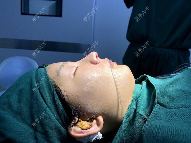 更美 - 肉嘟嘟儿的鼻部多项经验 | 杭州 | 鼻部多项