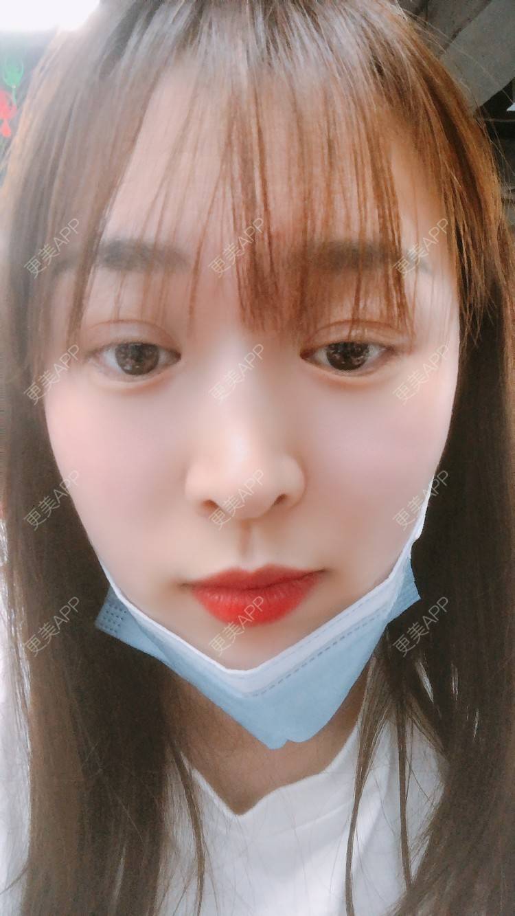 更美 - 更美用户nOSa2OXrxm的冷光美白经验 | 北京 | 冷光美白