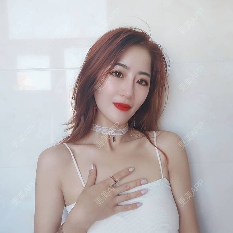 更美 - 王亚花的硅胶丰太阳穴经验 | 郑州 | 硅胶丰太阳穴 | 视频日记