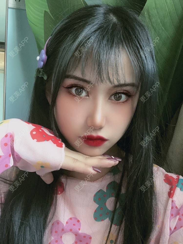 更美 - 地摊货也有春天的吸脂瘦脸经验 | 吸脂瘦脸 | 射频溶脂瘦脸 | 南京 | 光纤瘦脸