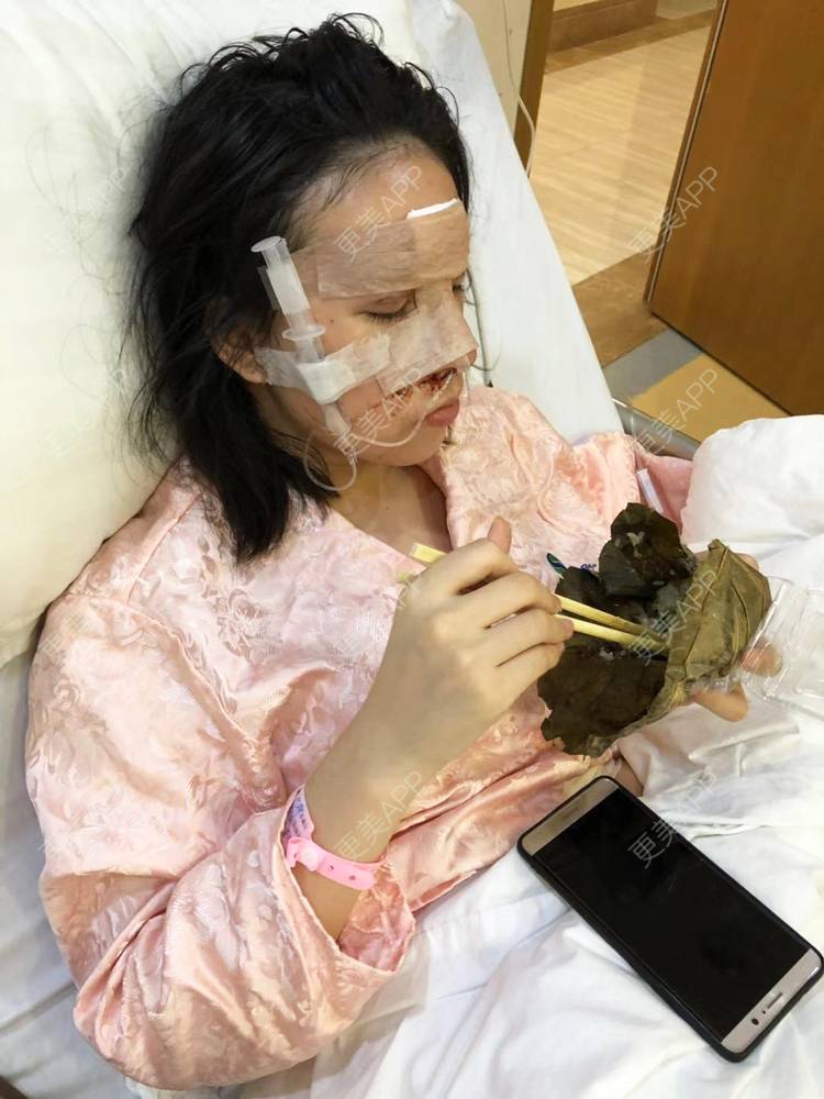 更美 - 琪琪琪琪琪琪琪琪琪的鼻部多项经验 | 鼻部多项 | 深圳