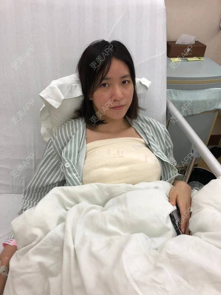 更美 - 琪琪琪琪琪琪琪琪琪的假体隆胸经验 | 假体隆胸 | 深圳