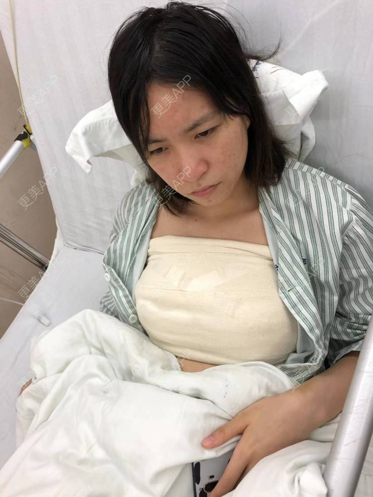 更美 - 琪琪琪琪琪琪琪琪琪的假体隆胸经验 | 假体隆胸 | 深圳