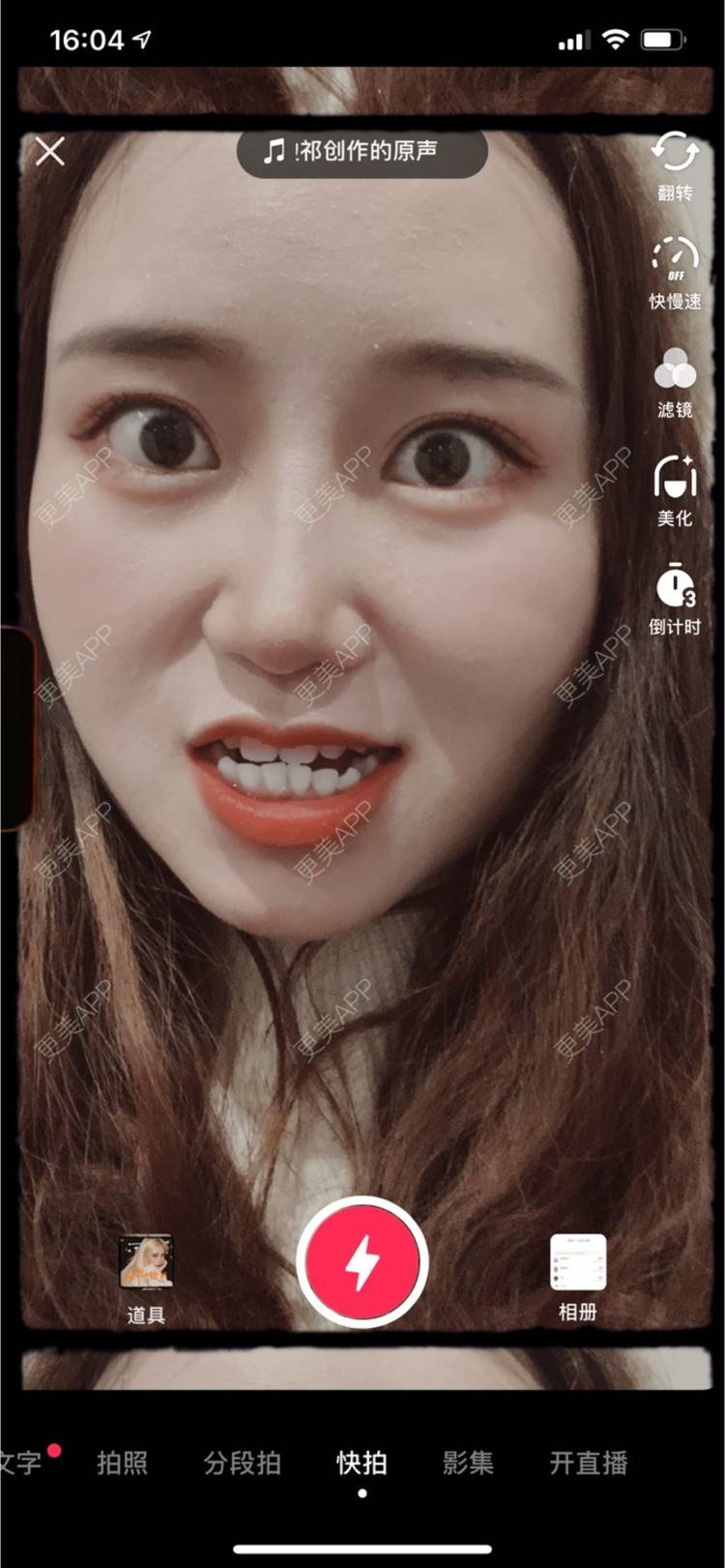 更美 - 圆方脸课代表ʚ😊ɞ的超声波洗牙经验 | 武汉 | 超声波洗牙