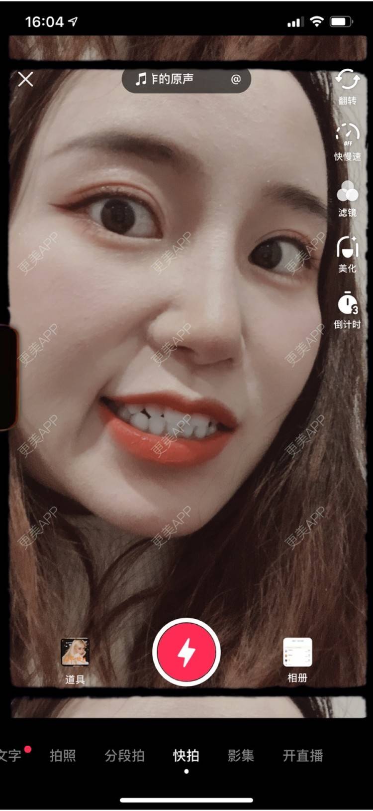 更美 - 圆方脸课代表ʚ😊ɞ的树脂补牙经验 | 武汉 | 树脂补牙