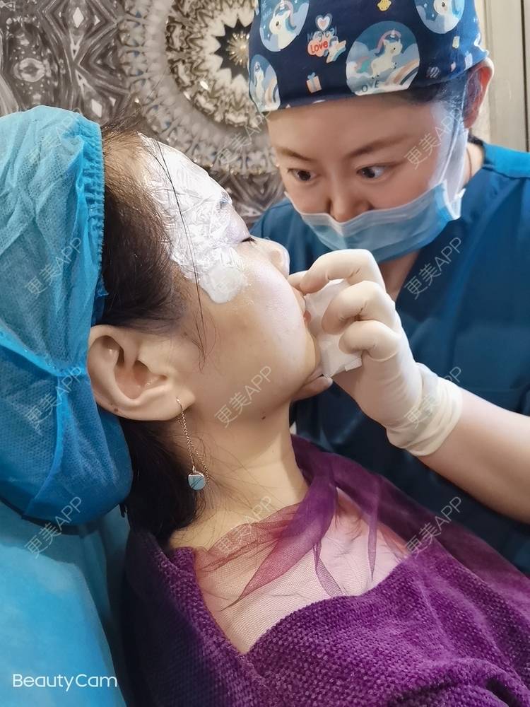 更美 - 苗苗美女的玻尿酸鼻基底经验 | 玻尿酸鼻基底 | 上海