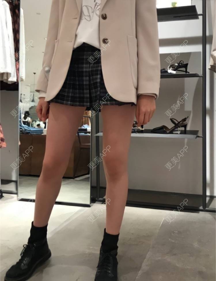 更美 - 更美用户czf9bjXMQu的吸脂经验 | 长沙 | 吸脂