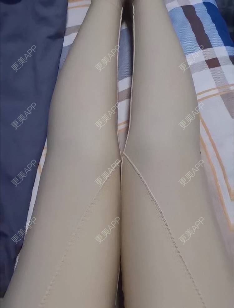 更美 - Ttuxrux的吸脂经验 | 长沙 | 吸脂