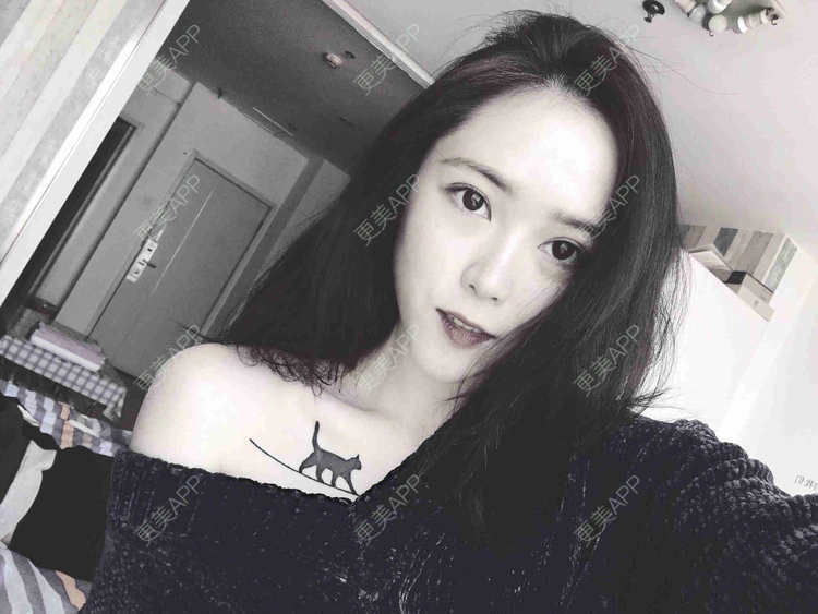 更美 - 暴力养猪妹到的颧骨颧弓经验 | 郴州 | 颧骨颧弓