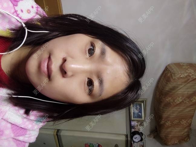 更美 - 写在歌里的玻尿酸鼻部经验 | 除皱瘦脸 | 上海