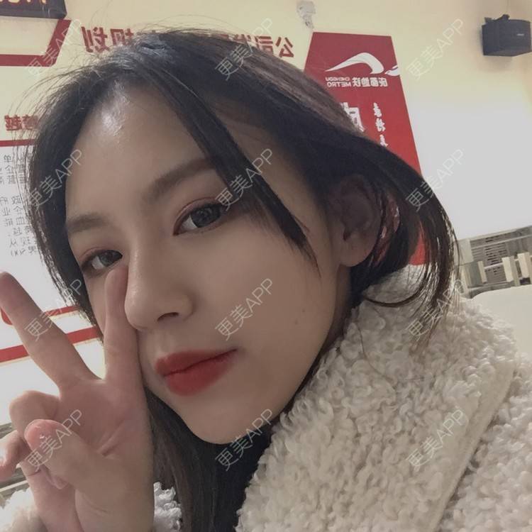 更美 - 吃飯從來用湯勺√的自体脂肪隆鼻经验 | 成都 | 自体脂肪隆鼻 | 视频日记