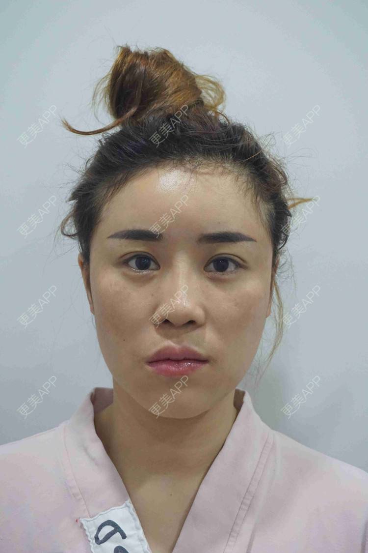 更美 - 穿花衣的燕子的鼻部多项经验 | 视频日记 | 鼻部多项 | 重庆