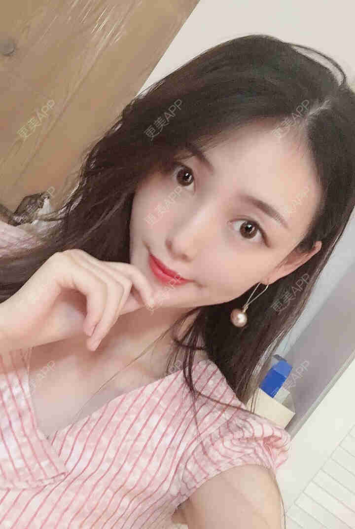 更美 - 芝麻芝麻开开门的自体脂肪全面部填充经验 | 自体脂肪全面部填充 | 视频日记 | 重庆