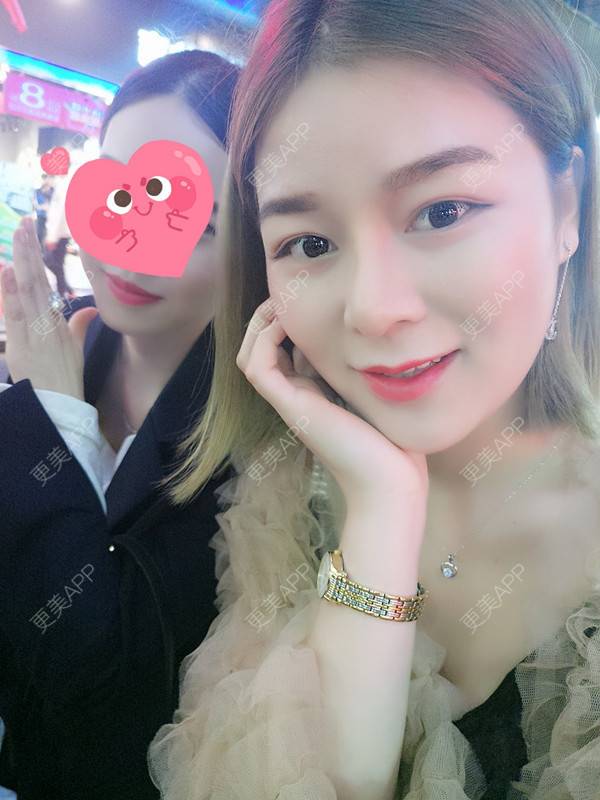 更美 - 長昼無亽戳的半永久美瞳线经验 | 北京 | 半永久美瞳线 | 半永久美瞳线