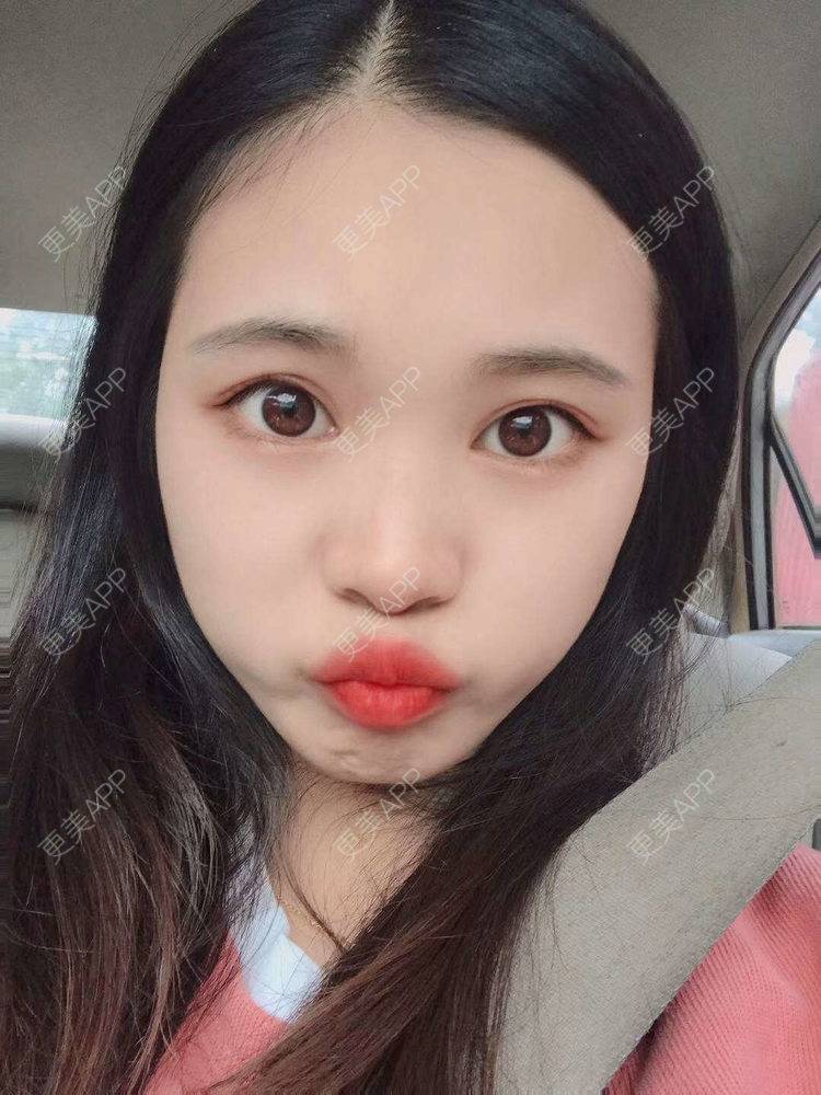 更美 - 更美^_^的眼部多项经验 | 眼部多项 | 广州