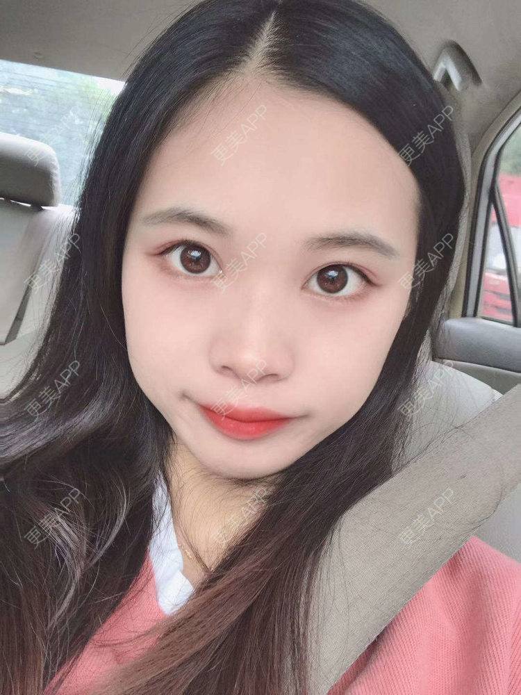 更美 - 更美^_^的眼部多项经验 | 眼部多项 | 广州