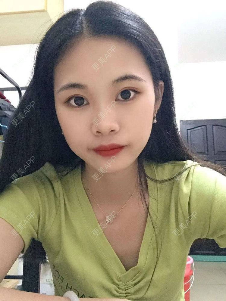 更美 - 更美^_^的眼部多项经验 | 眼部多项 | 广州