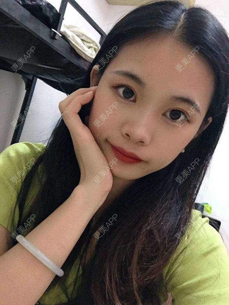 更美 - 更美^_^的眼部多项经验 | 眼部多项 | 广州