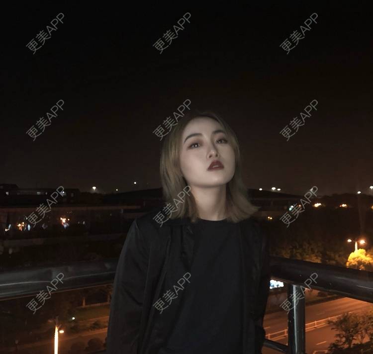 更美 - 誠意ナ到吃卟消ξ细的注射溶脂瘦脸经验 | 北京 | 注射溶脂瘦脸