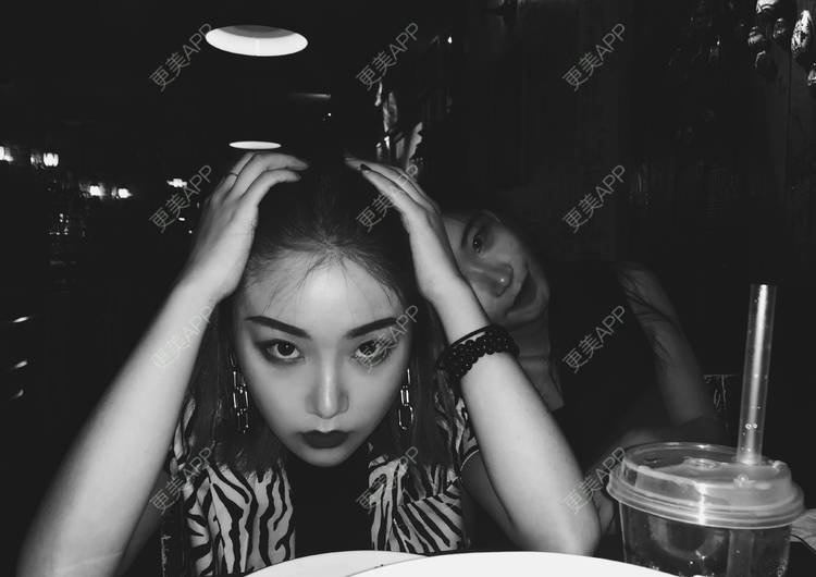 更美 - 誠意ナ到吃卟消ξ细的注射溶脂瘦脸经验 | 北京 | 注射溶脂瘦脸