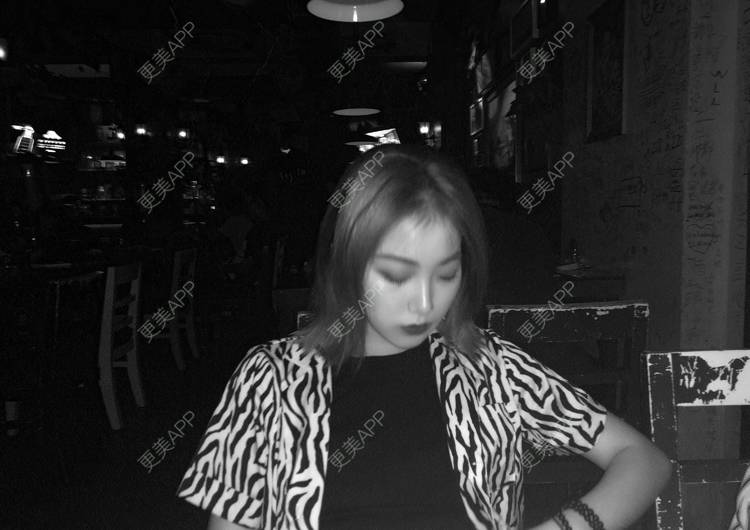 更美 - 誠意ナ到吃卟消ξ细的注射溶脂瘦脸经验 | 北京 | 注射溶脂瘦脸