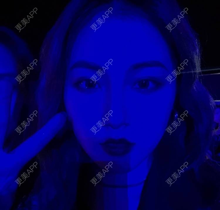 更美 - 誠意ナ到吃卟消ξ细的注射溶脂瘦脸经验 | 北京 | 注射溶脂瘦脸
