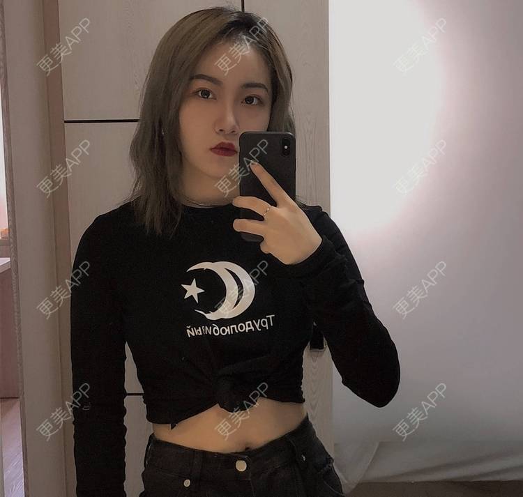更美 - 誠意ナ到吃卟消ξ细的注射溶脂瘦脸经验 | 北京 | 注射溶脂瘦脸