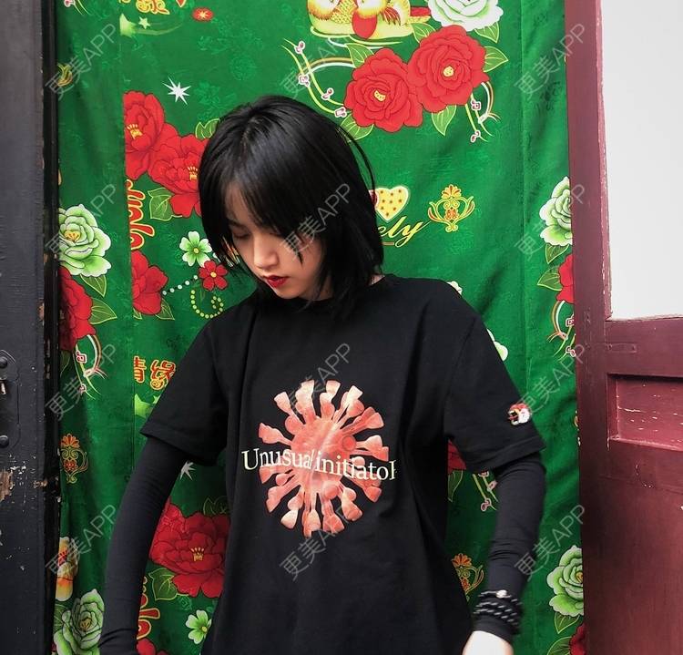更美 - 誠意ナ到吃卟消ξ细的注射溶脂瘦脸经验 | 北京 | 注射溶脂瘦脸
